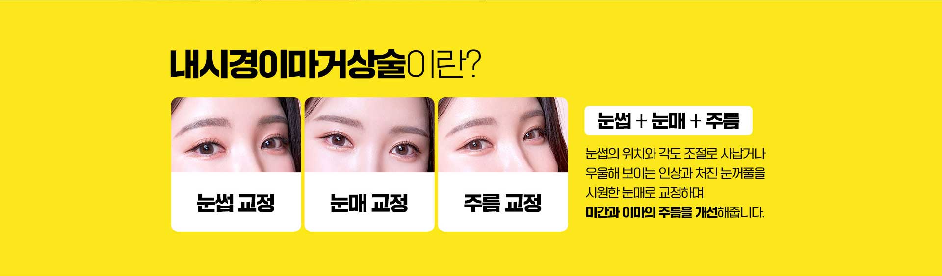내시경이마거상술이란?