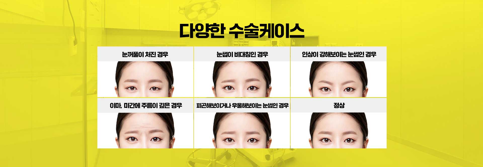 이마거상술 다양한 수술케이스