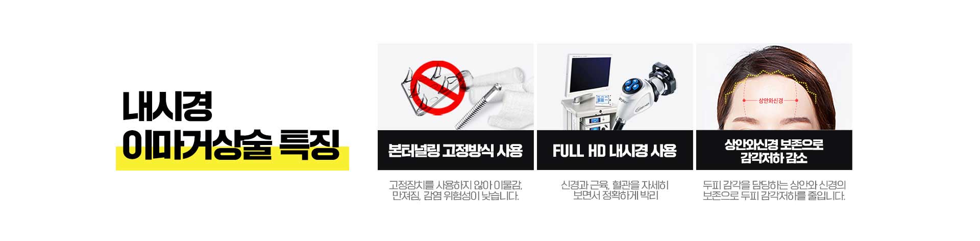 내시경 이마거상술의 특징